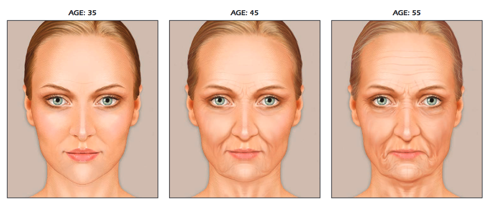 Facial Palsy Or Aging